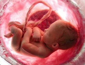 inf�rmate sobre la depresi�n neonatal